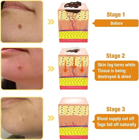 Barrier Build Skin Protectant Cream – Moisturizer with Ceramides Blume