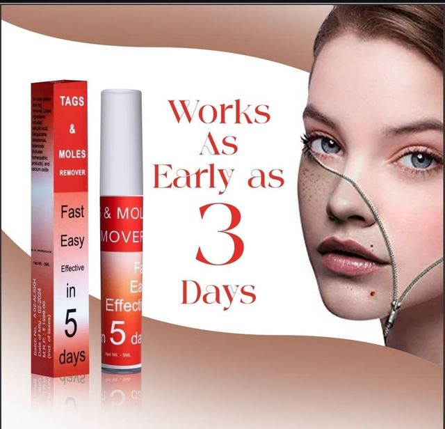 Lovilds Warts & Tags Remover Pen- Buy 1 Get 1 Free